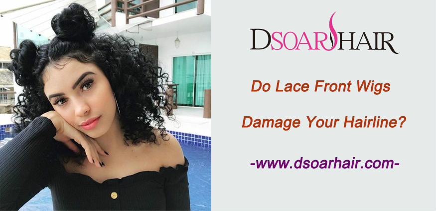 Do lace front wigs damage your hairline
